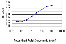 E - YY1 Antibody (monoclonal) (M05) AT4566a